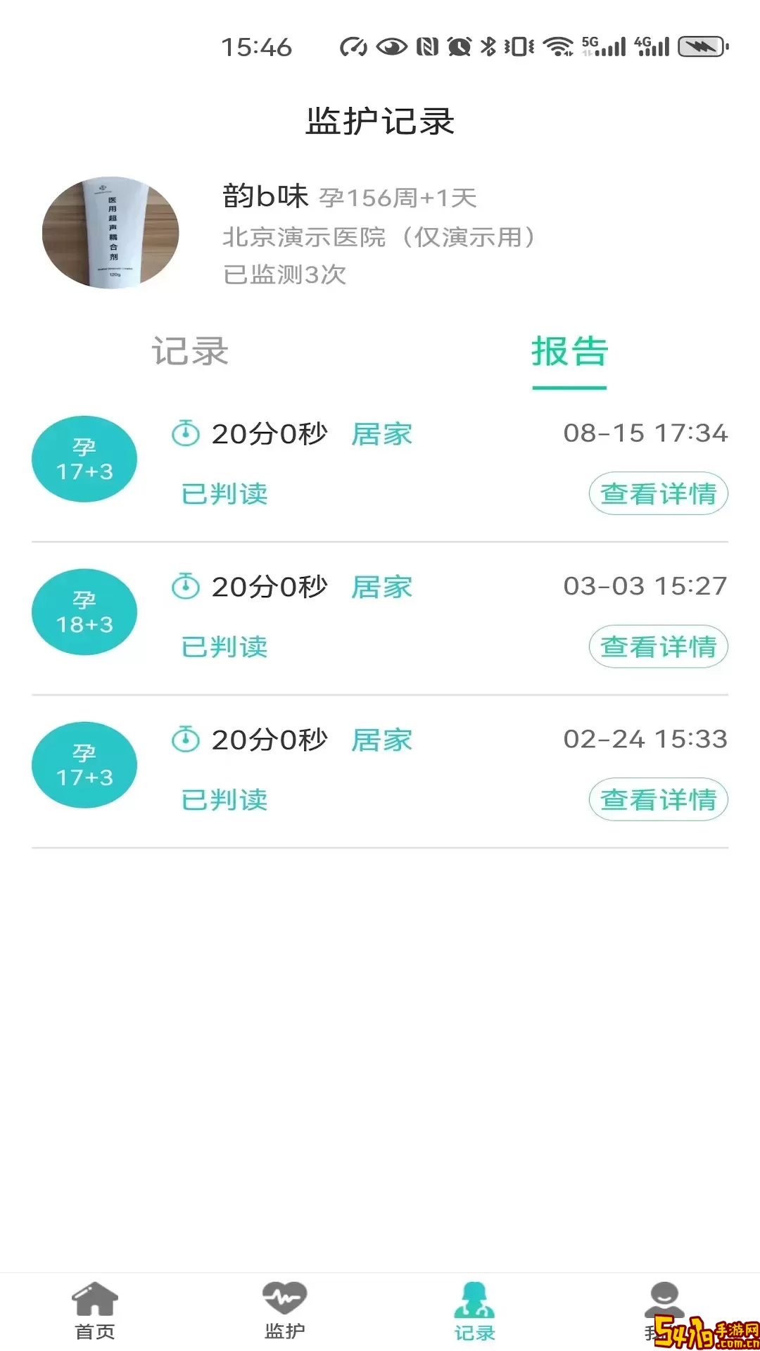 胎心监护最新版