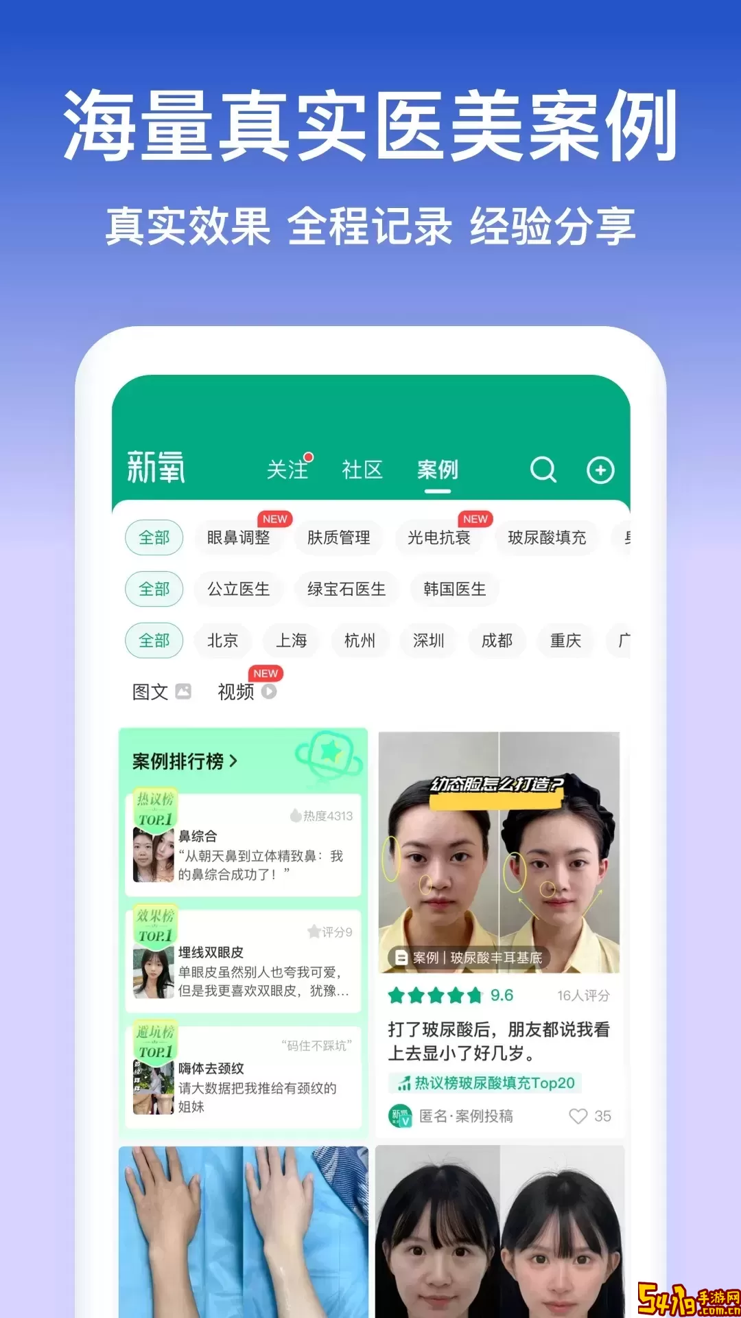 新氧极速版app下载